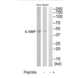 Western blot - IL18BP Antibody from Signalway Antibody (35224) - Antibodies.com