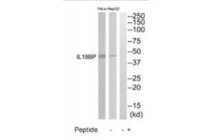 Western blot - IL18BP Antibody from Signalway Antibody (35224) - Antibodies.com