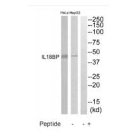 Western blot - IL18BP Antibody from Signalway Antibody (35224) - Antibodies.com