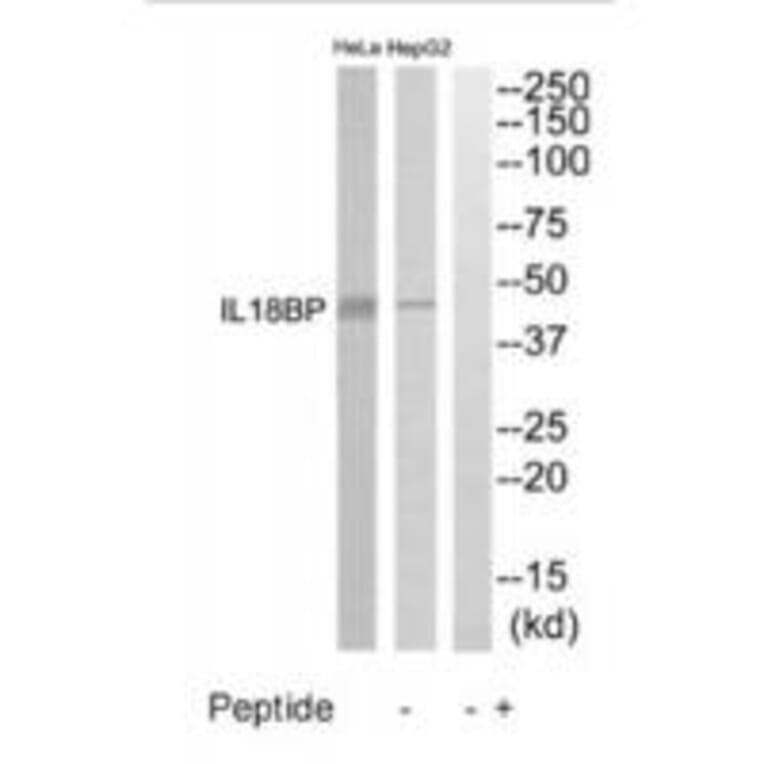 Western blot - IL18BP Antibody from Signalway Antibody (35224) - Antibodies.com