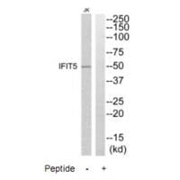 Western blot analysis of extracts from Jurkat cells, using IFIT5 antibody #35225.