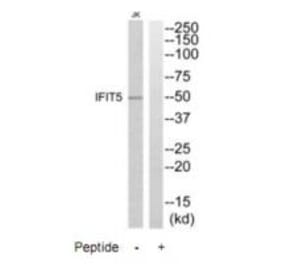 Western blot - IFIT5 Antibody from Signalway Antibody (35225) - Antibodies.com