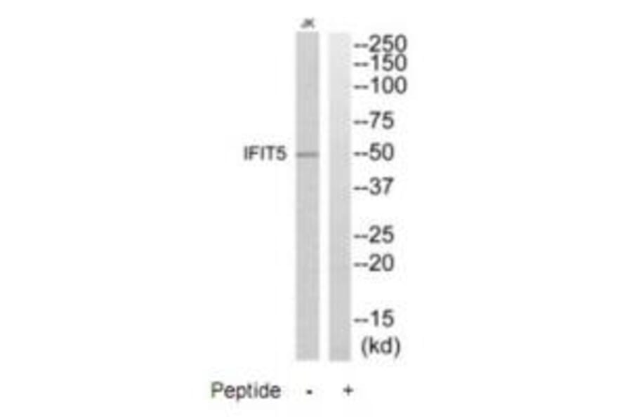 Western blot - IFIT5 Antibody from Signalway Antibody (35225) - Antibodies.com