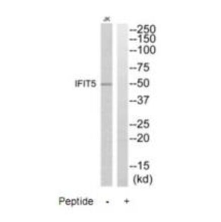 Western blot - IFIT5 Antibody from Signalway Antibody (35225) - Antibodies.com