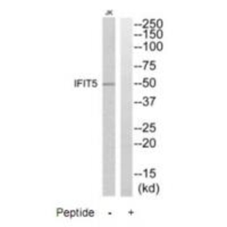 Western blot - IFIT5 Antibody from Signalway Antibody (35225) - Antibodies.com