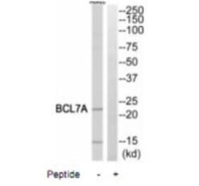 Western blot - BCL7A Antibody from Signalway Antibody (35248) - Antibodies.com