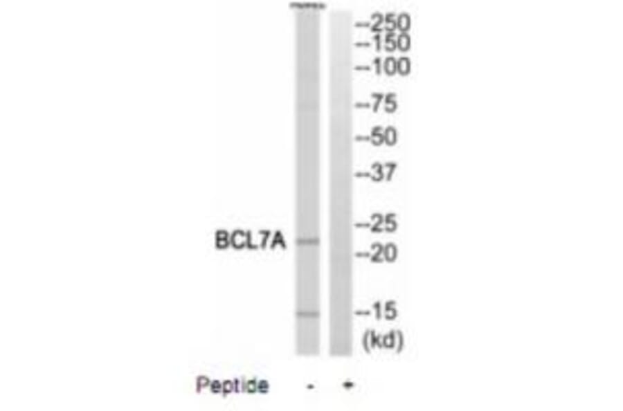 Western blot - BCL7A Antibody from Signalway Antibody (35248) - Antibodies.com