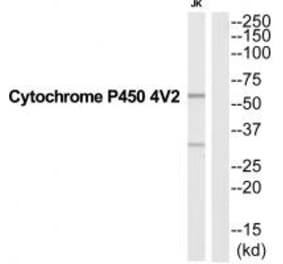 Western blot - CYP4V2 Antibody from Signalway Antibody (35255) - Antibodies.com