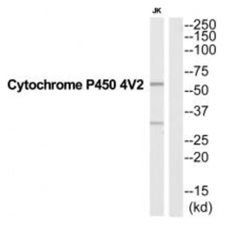 Western blot - CYP4V2 Antibody from Signalway Antibody (35255) - Antibodies.com