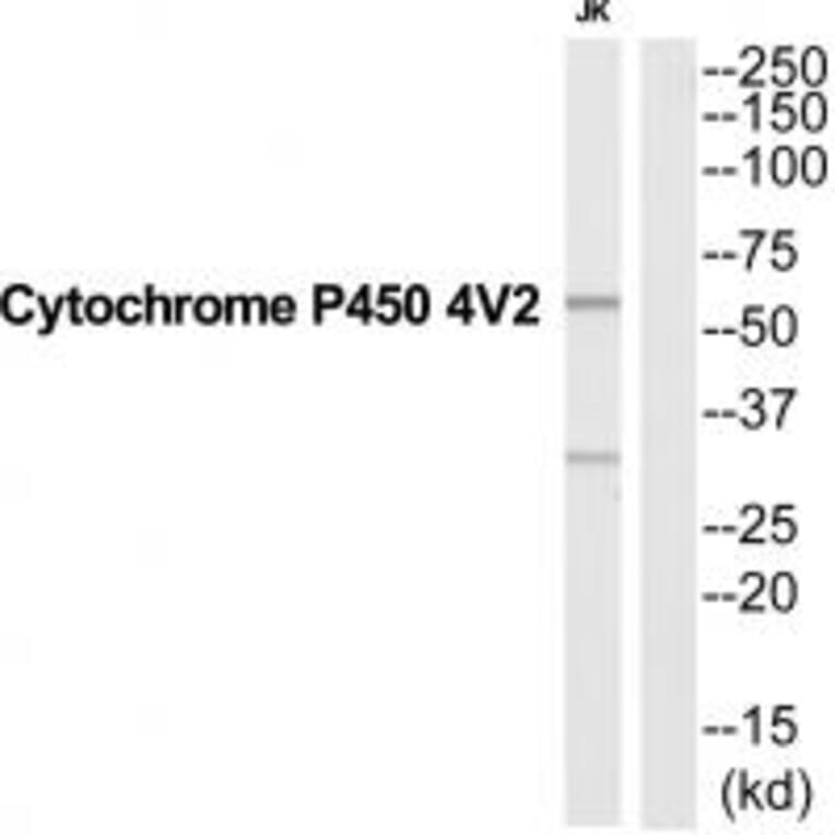 Western blot - CYP4V2 Antibody from Signalway Antibody (35255) - Antibodies.com