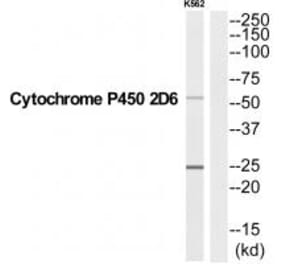 Western blot - CYP2D6 Antibody from Signalway Antibody (35258) - Antibodies.com