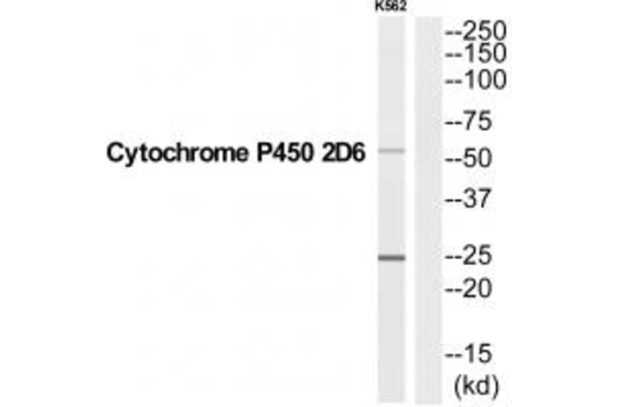 Western blot - CYP2D6 Antibody from Signalway Antibody (35258) - Antibodies.com