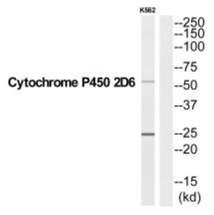 Western blot - CYP2D6 Antibody from Signalway Antibody (35258) - Antibodies.com