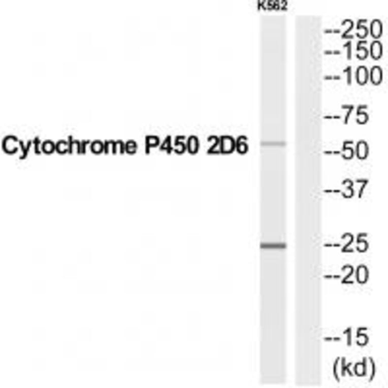 Western blot - CYP2D6 Antibody from Signalway Antibody (35258) - Antibodies.com