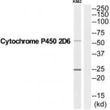 Western blot - CYP2D6 Antibody from Signalway Antibody (35258) - Antibodies.com
