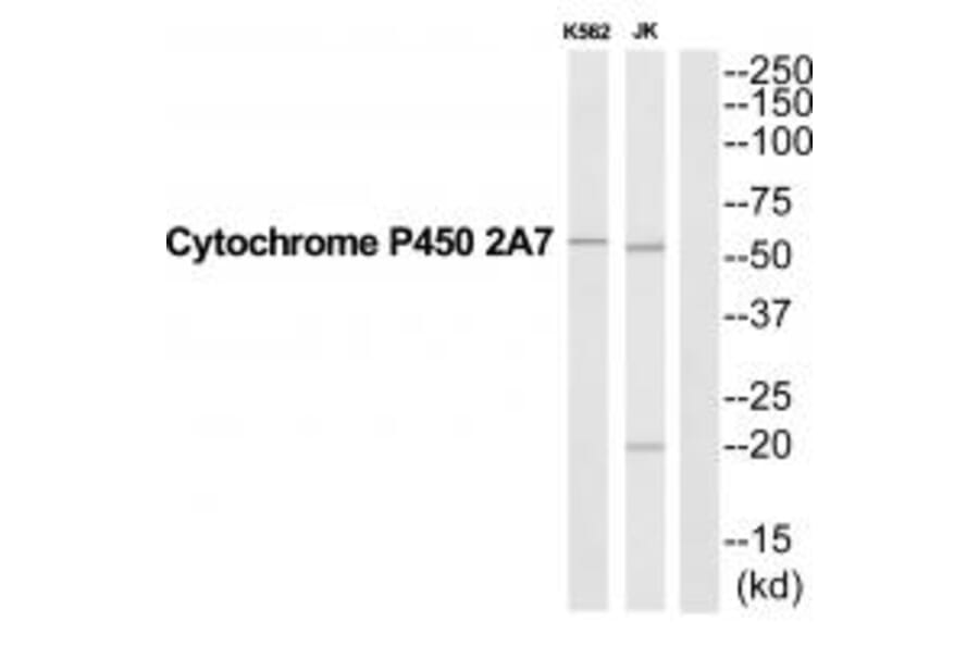 Western blot - CYP2A7 Antibody from Signalway Antibody (35266) - Antibodies.com