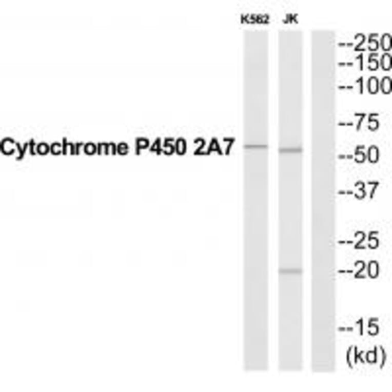 Western blot - CYP2A7 Antibody from Signalway Antibody (35266) - Antibodies.com