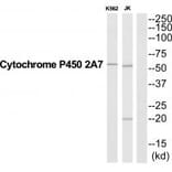 Western blot - CYP2A7 Antibody from Signalway Antibody (35266) - Antibodies.com