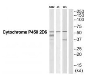 Western blot - CYP2D6 Antibody from Signalway Antibody (35267) - Antibodies.com