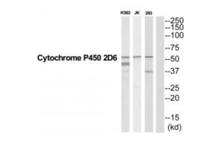 Western blot - CYP2D6 Antibody from Signalway Antibody (35267) - Antibodies.com