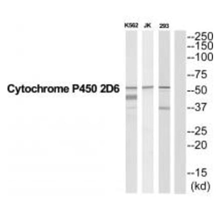 Western blot - CYP2D6 Antibody from Signalway Antibody (35267) - Antibodies.com