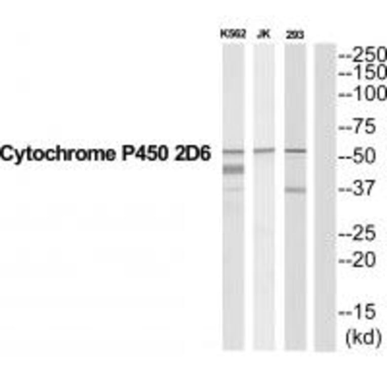 Western blot - CYP2D6 Antibody from Signalway Antibody (35267) - Antibodies.com