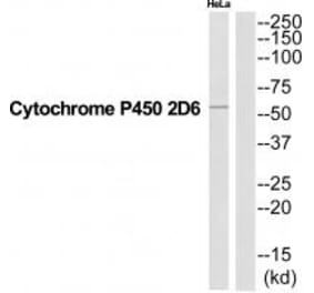 Western blot - CYP2D6 Antibody from Signalway Antibody (35269) - Antibodies.com