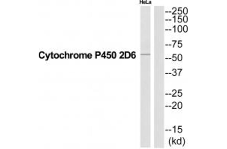 Western blot - CYP2D6 Antibody from Signalway Antibody (35269) - Antibodies.com