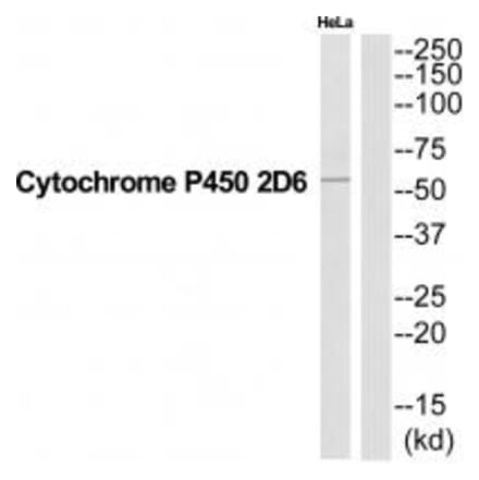 Western blot - CYP2D6 Antibody from Signalway Antibody (35269) - Antibodies.com