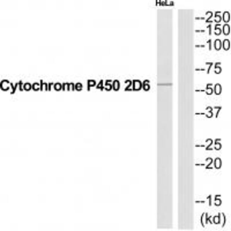 Western blot - CYP2D6 Antibody from Signalway Antibody (35269) - Antibodies.com