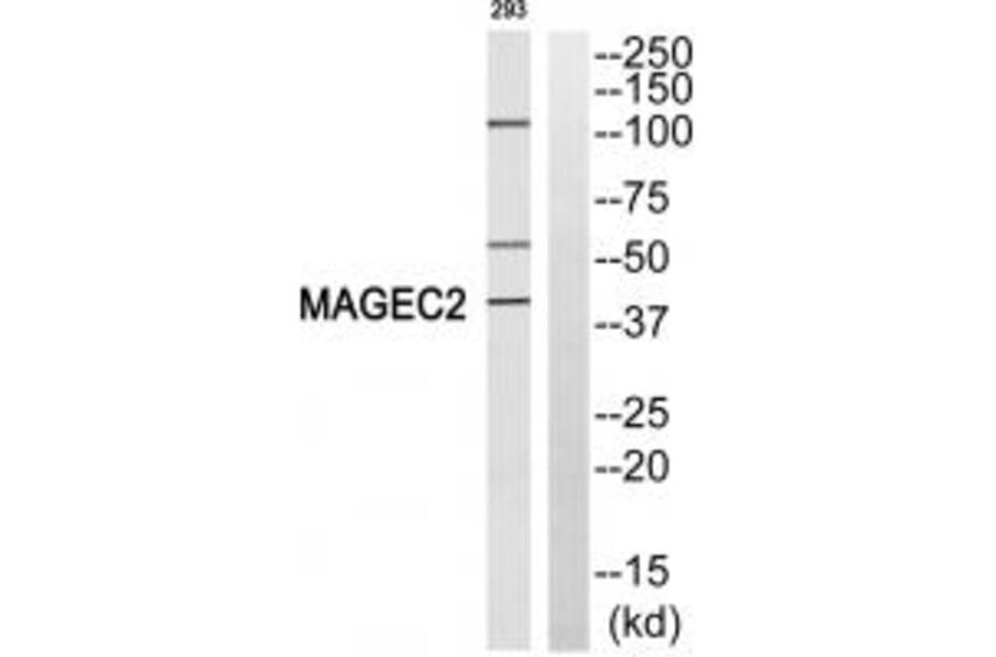 Western blot - MAGEC2 Antibody from Signalway Antibody (35279) - Antibodies.com