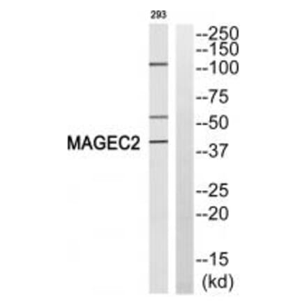 Western blot - MAGEC2 Antibody from Signalway Antibody (35279) - Antibodies.com