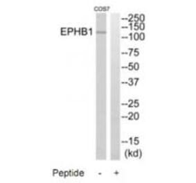 Western blot - EPHB1 Antibody from Signalway Antibody (35286) - Antibodies.com