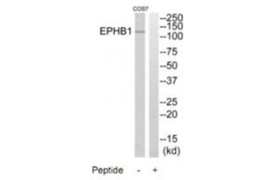 Western blot - EPHB1 Antibody from Signalway Antibody (35286) - Antibodies.com