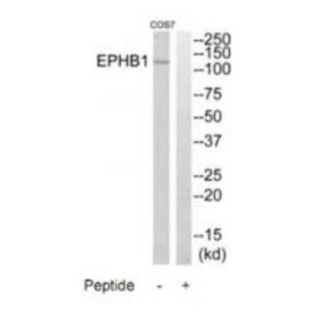 Western blot - EPHB1 Antibody from Signalway Antibody (35286) - Antibodies.com