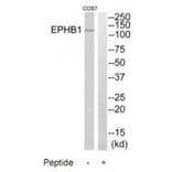 Western blot - EPHB1 Antibody from Signalway Antibody (35286) - Antibodies.com
