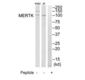 Western blot - MERTK Antibody from Signalway Antibody (35290) - Antibodies.com