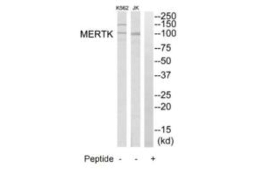Western blot - MERTK Antibody from Signalway Antibody (35290) - Antibodies.com