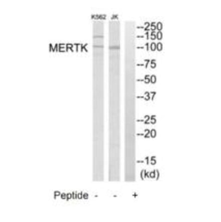 Western blot - MERTK Antibody from Signalway Antibody (35290) - Antibodies.com