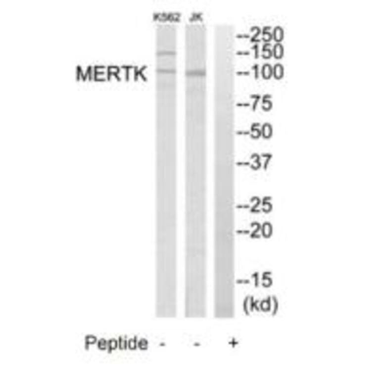 Western blot - MERTK Antibody from Signalway Antibody (35290) - Antibodies.com