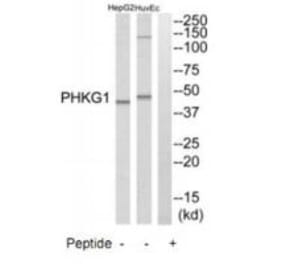 Western blot - PHKG1 Antibody from Signalway Antibody (35293) - Antibodies.com