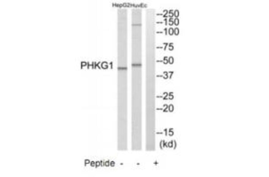 Western blot - PHKG1 Antibody from Signalway Antibody (35293) - Antibodies.com