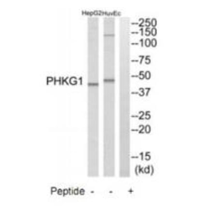 Western blot - PHKG1 Antibody from Signalway Antibody (35293) - Antibodies.com