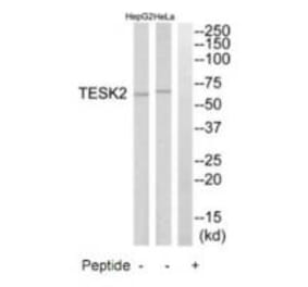 Western blot - TESK2 Antibody from Signalway Antibody (35299) - Antibodies.com