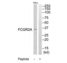 Western blot - FCGR2A Antibody from Signalway Antibody (35305) - Antibodies.com