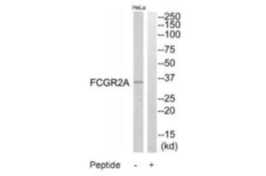 Western blot - FCGR2A Antibody from Signalway Antibody (35305) - Antibodies.com