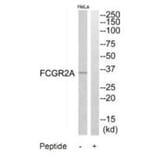 Western blot - FCGR2A Antibody from Signalway Antibody (35305) - Antibodies.com