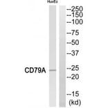 Western blot - CD79A Antibody from Signalway Antibody (35306) - Antibodies.com