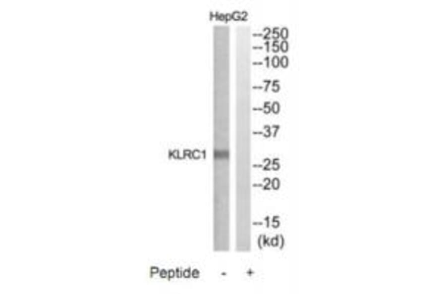Western blot - KLRC1 Antibody from Signalway Antibody (35310) - Antibodies.com