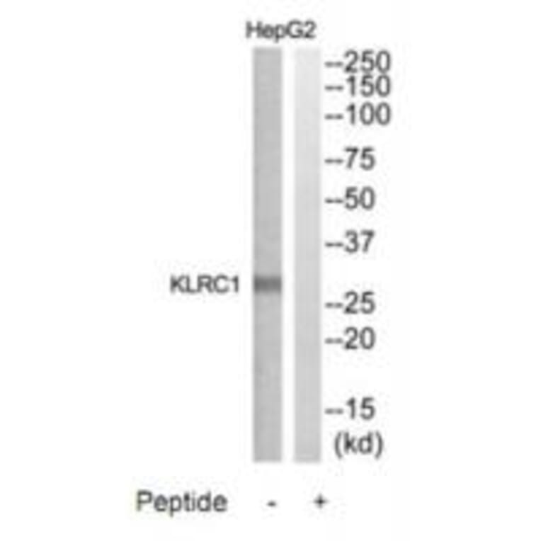 Western blot - KLRC1 Antibody from Signalway Antibody (35310) - Antibodies.com
